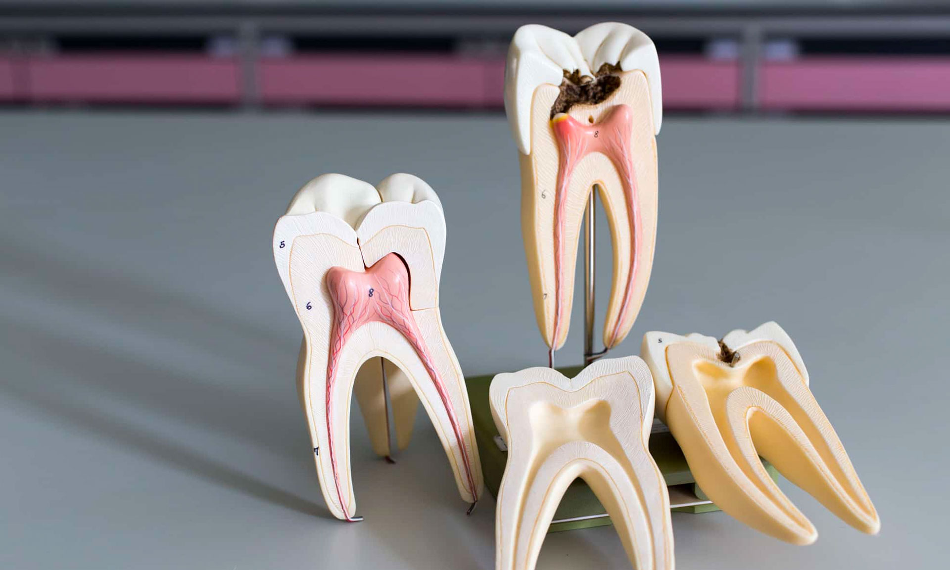 https://thedentalgroupatcentralcity.com/wp-content/uploads/2023/12/root-canal-treatment.jpg